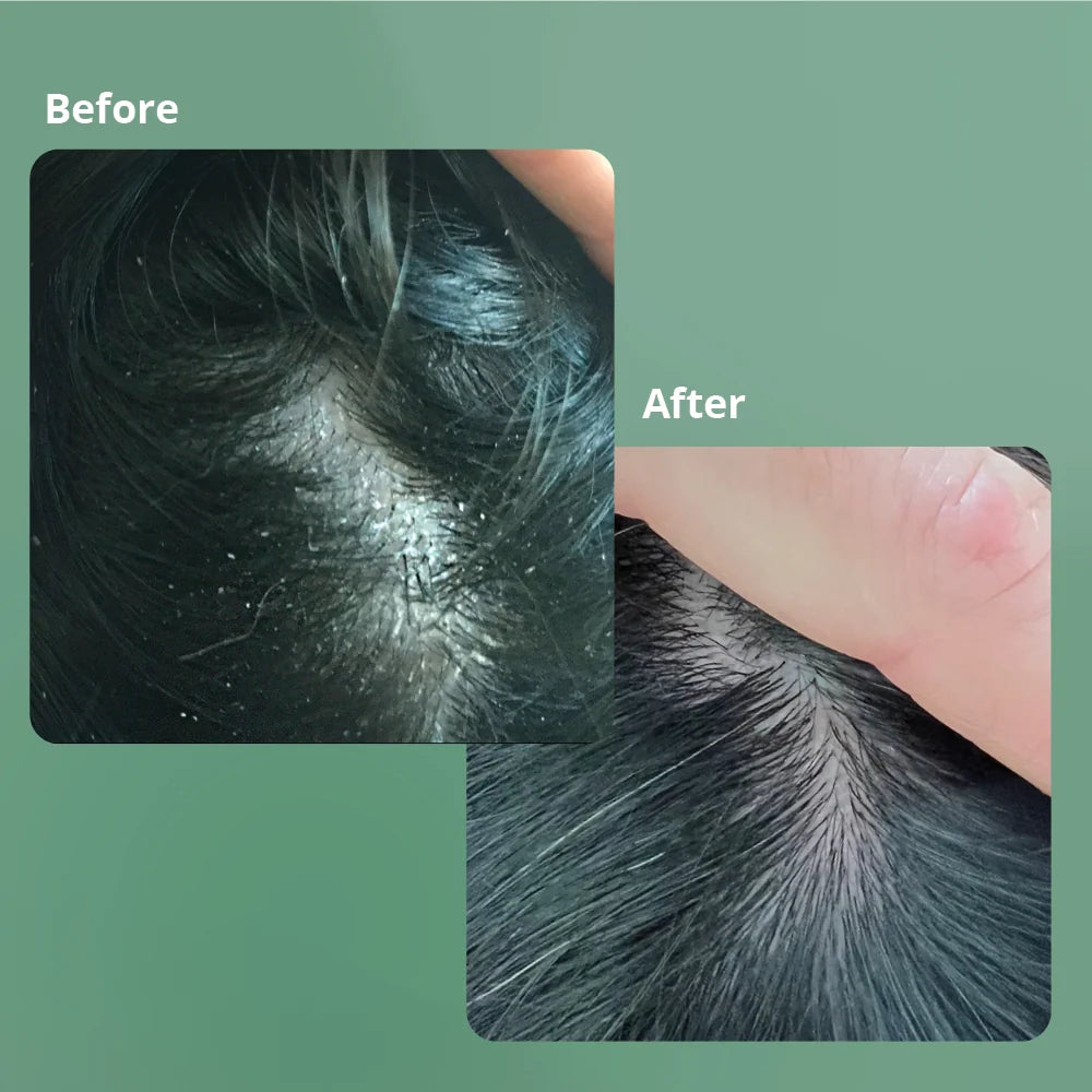 Particular Scalp Serum